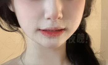 头条女神 – 尹菲御姐写真合集来袭：绝美套图助你征服夜晚！